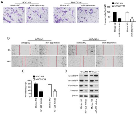 Interaction Between Mir‑206 And Lncrna Malat1 In Regulating Viability