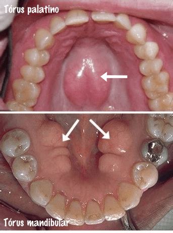 Muito Bom Esse Caf Anomalias Dent Rias Radiologia