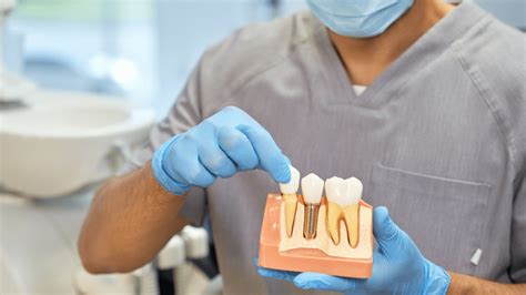 What Are Dental Implants Made Of How Dental Implants Work