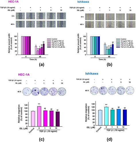 Figure 2 From Isoliquiritigenin Reverses Epithelial Mesenchymal