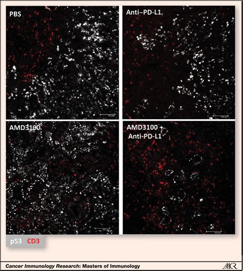 Figure 1 from The Carcinoma-Associated Fibroblast Expressing Fibroblast ... 