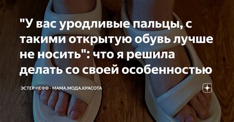 "У вас уродливые пальцы, с такими открытую обувь лучше не носить": что ...