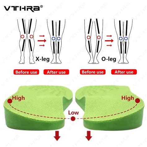 O X Leg Orthopedic Insoles Arch Support Insole Corrigibil Bow Legs