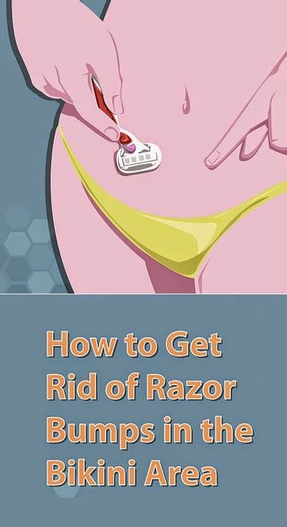 How To Get Rid Of Razor Bumps In The Bikini Area