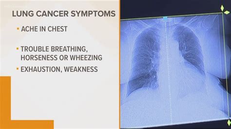 What Are The Symptoms If You Have Lung Cancer : Lung Cancer Macmillan Cancer Support : Both ...