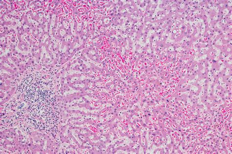 현미경 간 조직 H E 염색 간세포 인간의 세포에 대한 스톡 사진 및 기타 이미지 간세포 인간의 세포 세포 건강관리와
