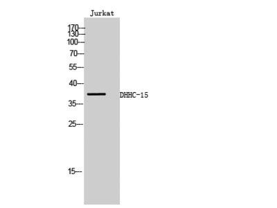 DHHC 15 Polyclonal Antibody MBS2538196 From MyBioSource