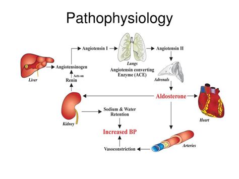 Ppt Renovascular Hypertension Powerpoint Presentation Free Download Id 5732519