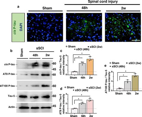 Severe Sci Had A Robust And Persistent Effect On Tau Pathogenicity