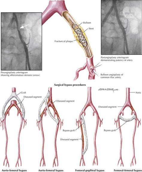 Lower Limb Basicmedical Key