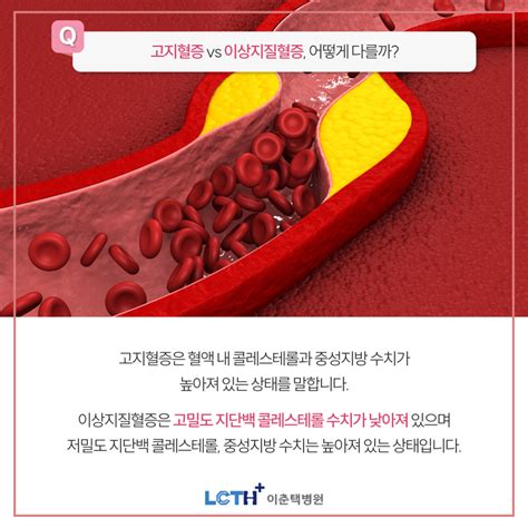 고지혈증 Vs 이상지질혈증 차이는 Ldl Hdl 콜레스테롤 중성지방 콜레스테롤 수치 낮추는 음식 네이버 블로그