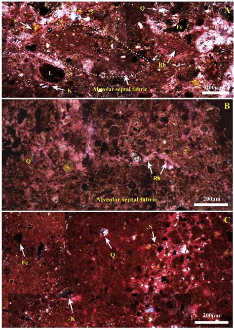 Mosaic Of Microphotographs Showing A Root Calcrete Having Reddish