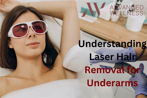 Understanding Laser Hair Removal For Underarms 7 Questions To Ask