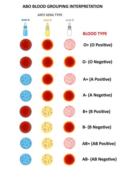 5 Abo Blood Grouping Interpretation Images Stock Photos 3D Objects