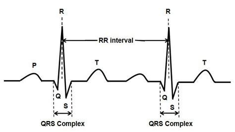 R Wave Qrs Complex And Rr Interval In Standard Ecg Signals Download Scientific Diagram