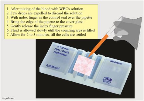 How To Perform A Manual Platelet Count