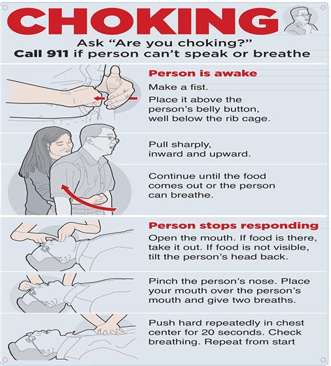 The Guide About What To Do In Case Of Choking Aluminum Signs X