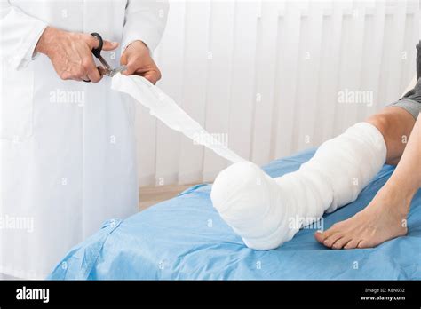 Hospital Plaster Cast Leg Hi Res Stock Photography And Images Alamy