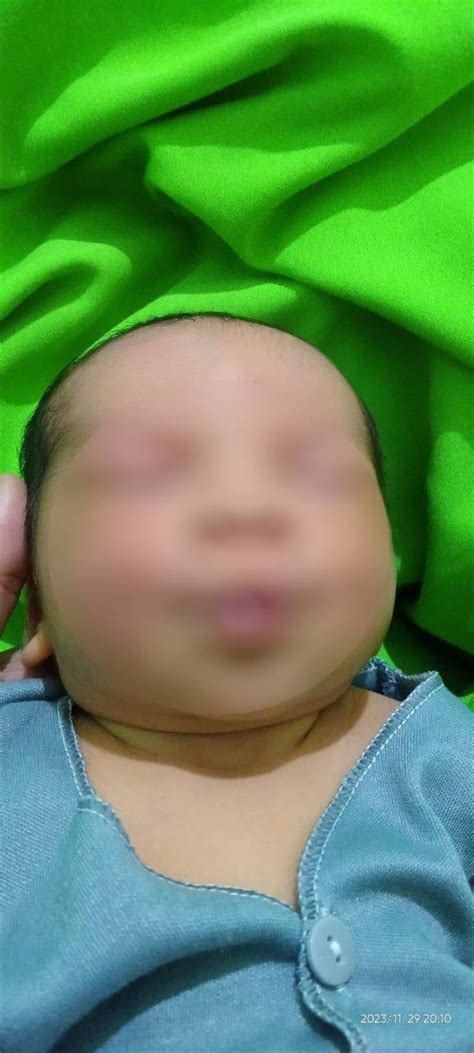 Kisah Bayi Devandra Meninggal Usai Dipijat Neneknya Sejak Umur Hari