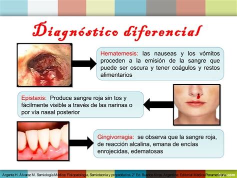 Tos Expectoraci N Hemoptisis Ppt