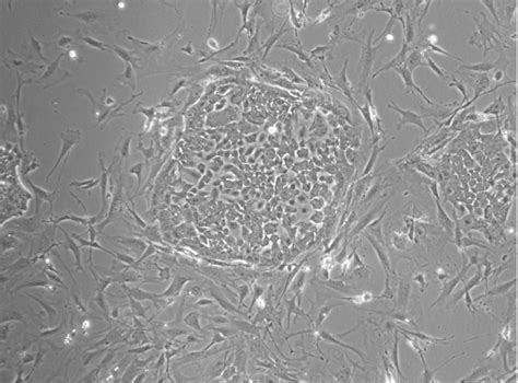 Isolation Of Mammary Epithelial Cells And Fibroblasts From Mouse Tumor