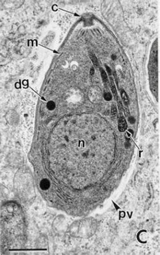 Toxoplasma Gondii Flashcards Quizlet