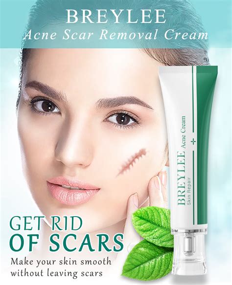 Breylee Acne Scar Removal Cream Treatment Remove Stretch Marks Acne