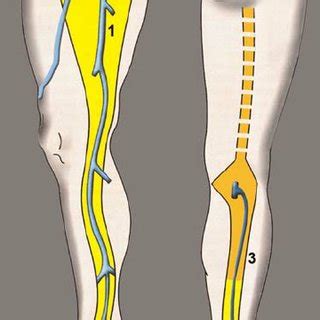 (PDF) Anatomy and embryology of the small saphenous vein: Nerve ...