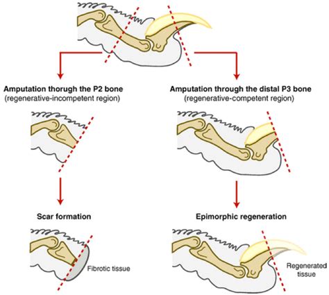 Could Humans Ever Regenerate Limbs Kurzweil