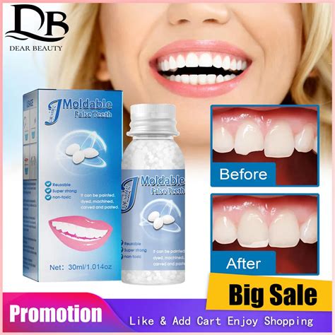 30ml Dental Resin Shapeable Teeth Glue Makeup Dentures Modification