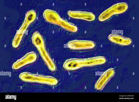 Clostridium Botulinum Fotografías E Imágenes De Alta Resolución Alamy