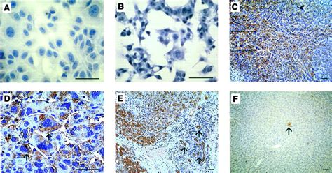 Potential Interaction Between Ccr1 And Its Ligand Ccl3 Induced By