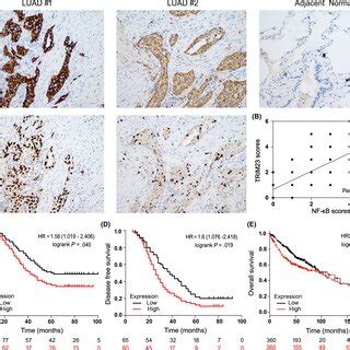 Elevated Trim Expression Predicts Poor Prognosis A Trim And