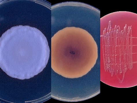 Dimorphic Systemic Mycoses Mycology University Of Adelaide