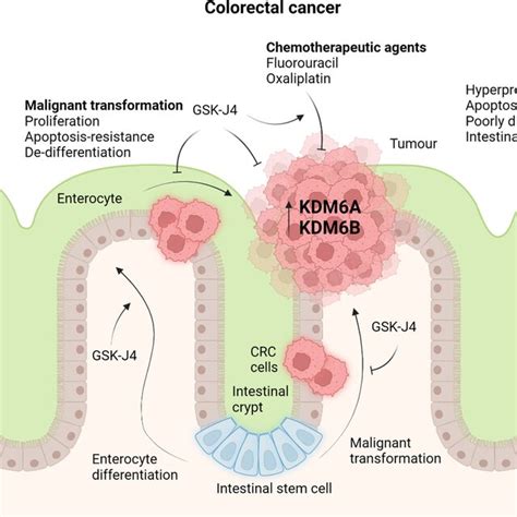 Kdm6akdm6b Inhibition In Colorectal Cancer Kdm6ab Expression