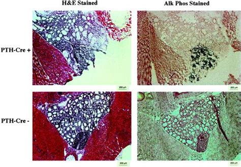 Parathyroid Gland Specific Deletion Of The Mouse Men1 Gene Results In