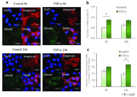 Tnf α Promotes The Synthesis Of Extracellular Odam A Collagenase