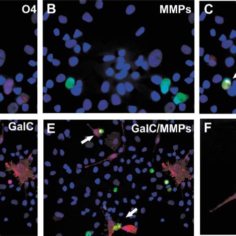 Co Localization Of Active Forms Of Mmps Detected By In Situ