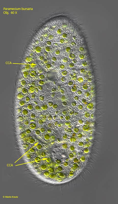 Paramecium Aurelia And Paramecium Caudatum