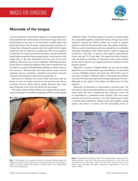 Pdf Mucocele Of The Tongue