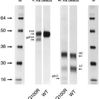 Sds Page Analysis Of Wild Type And Variant Q Rfvii Before And After