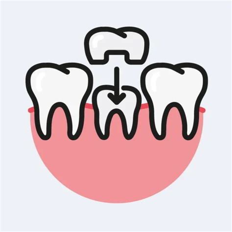 Dental Crowns • Synergy Dental Clinic