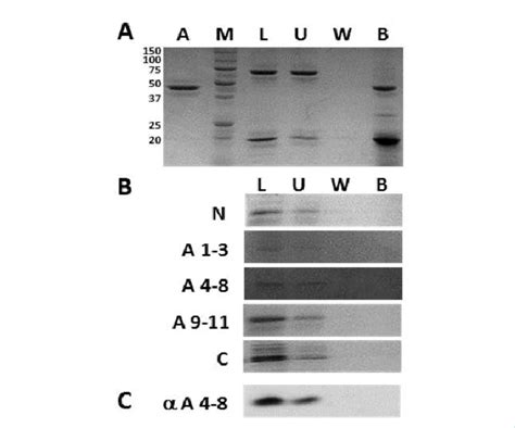 Actin Affinity Pulls Down Assay A SDS PAGE With Coomassie Staining Of