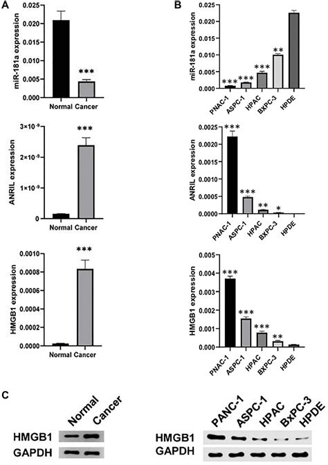 Lncrna Anril Aggravates The Chemoresistance Of Pancreatic Cancer Cells