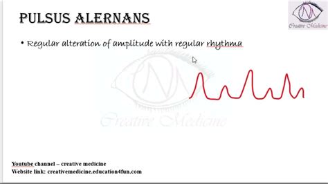 Lec 4 Pulsus Alternans Cardiology YouTube