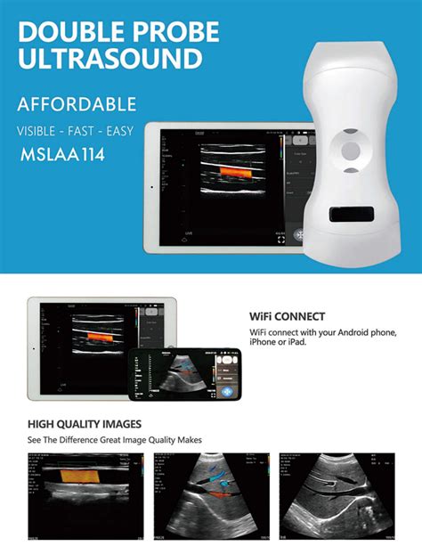 Elements Convex Linear Phased Array Color Doppler Ultrasound