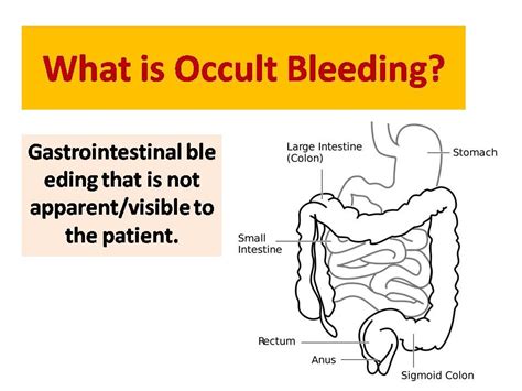 Occult Blood Test Stool - HEWQKE