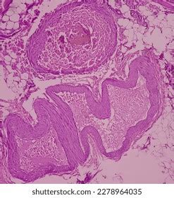 Chronic Anal Fissure Fistula Histology Fistulous Stock Photo 2278964035 | Shutterstock