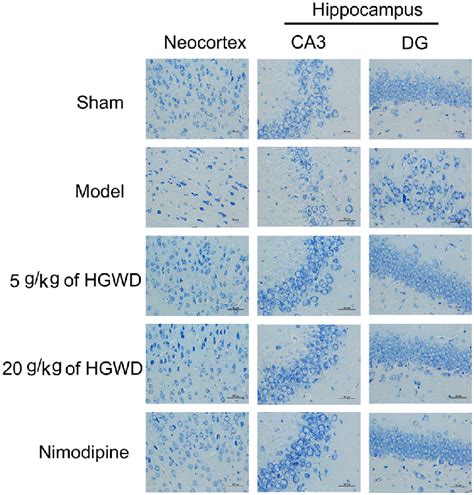 HGWD Decreased Cerebral I R Induced Nissl Body Loss Nissl Staining