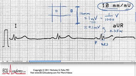 Size And Timing Scale 6 2 Ecg Ekg Interpretation Basic Youtube